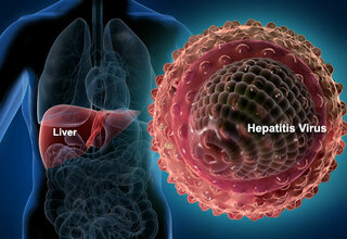 Hepatitis Masih Jadi Masalah Kesehatan Dunia