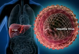 Kasus Hepatitis Bertambah, IDAI Belum Rekomendasikan Tunda PTM