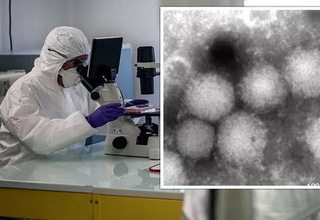 Peneliti Jepang Temukan Penyakit Menular Baru Akibat Virus Yezo