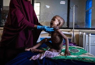 Bencana Kelaparan Membayangi 7,1 Juta Rakyat Somalia