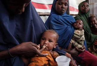 UNICEF:700 Anak Somalia Meninggal Akibat Malnutrisi Akut