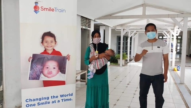 Hadirkan Senyum dan Harapan Baru untuk Anak Sumbing di Aceh