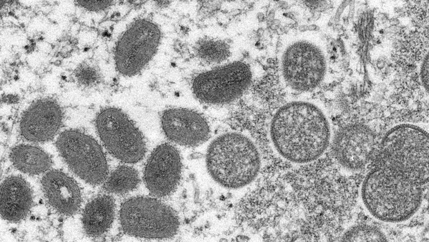 WHO menyatakan kemungkinan mutasi cenderung lebih rendah pada virus cacar monyet.