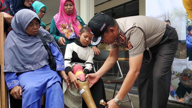 Foto dokumentasi bakti sosial Polri. Polres Sukabumi Kota memberikan sumbangan kaki palsu kepada sejumlah penyandang disabilitas.