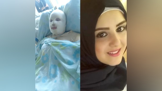 Hana Mohammed Khodor, wanita berusia 21 tahun dilarikan ke rumah sakit di Lebanon dalam kondisi kritis.
