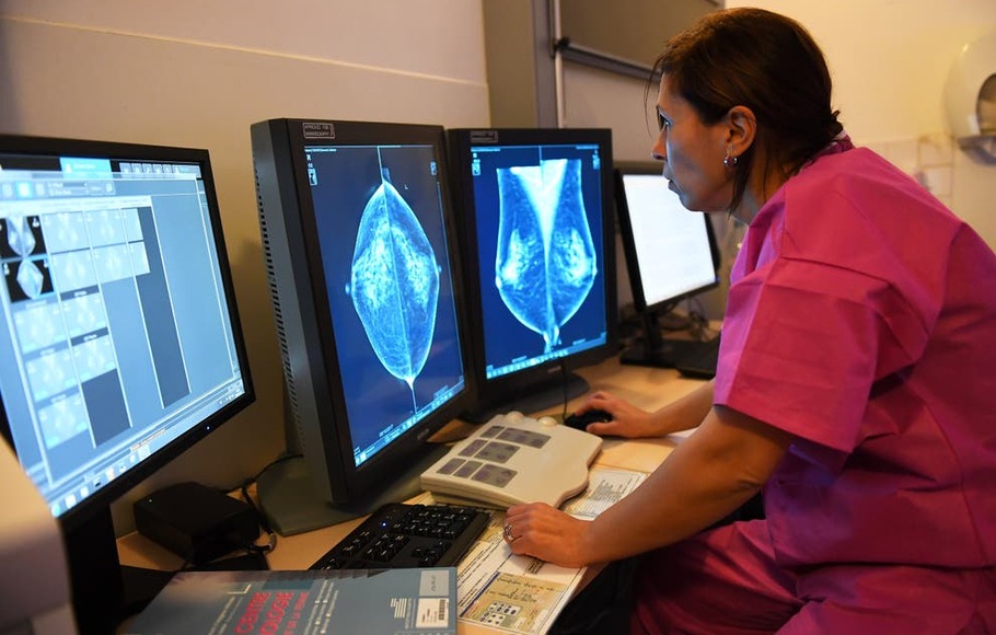 Petugas medis melakukan pemeriksaan kasus kanker payudara.