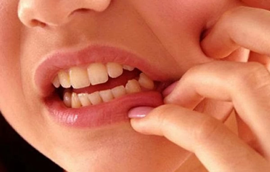 Obat sakit gigi alami ini, bisa bantu bebaskan Anda dari rasa sakit yang mengganggu.