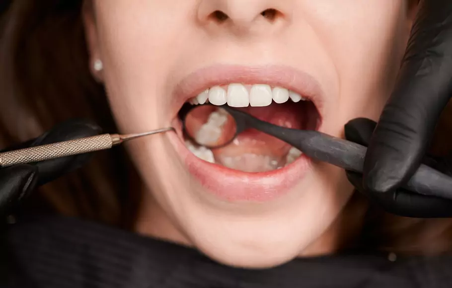 Memiliki kondisi gigi berlubang bisa terasa sangat menyakitkan, beberapa hal ini bisa menjadi penyebab gigi berlubang dan Anda harus menghindarinya.