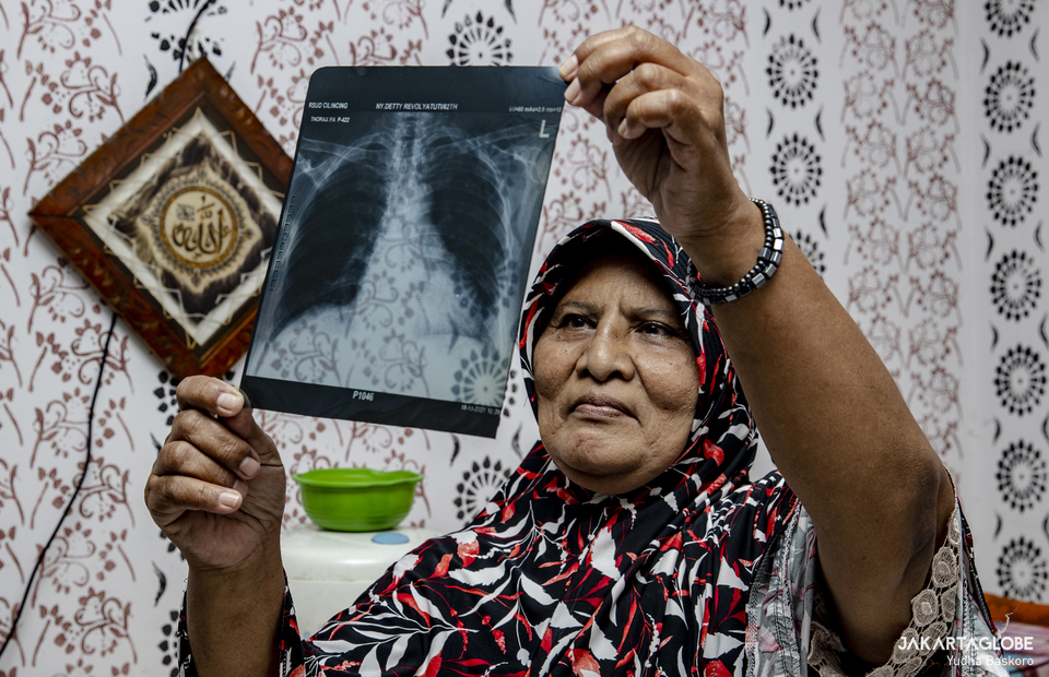 Detty Revolyatuti, 62, shows her thorax roengent as she suffers monthly hard cough with negative result of covid-19 test due to coal ash and dust pollution at Rusunawa Marunda, Cilincing, North Jakarta on April 25, 2022. (JG Photo/Yudha Baskoro) 